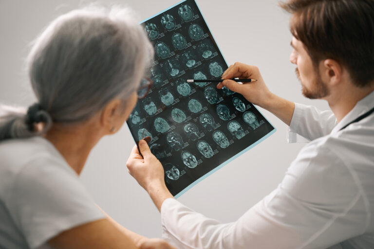 alzheimer-prota-stadia