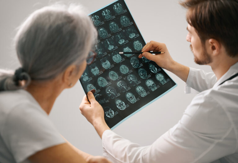 alzheimer-prota-stadia