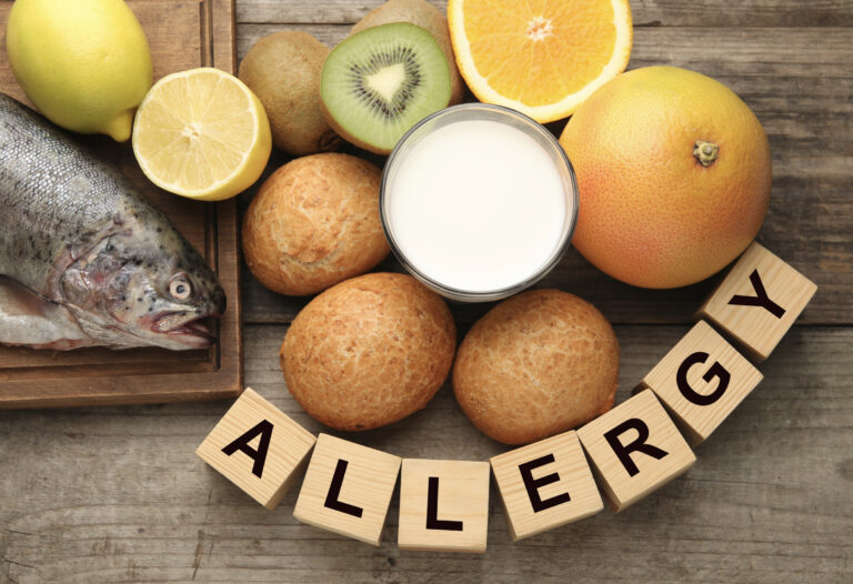 filoxenia-kalesmenon-me-trofikes-allergies