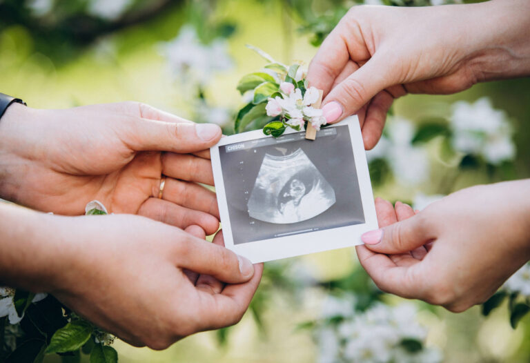 fisikoi-tropoi-na-enisxiseis-tin-gonimotita